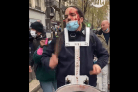 موسيقي الفرنسي يصرّ على العزف أمام الشرطة رغم أن وجهه ينزف دما عقب تعرضه للضرب