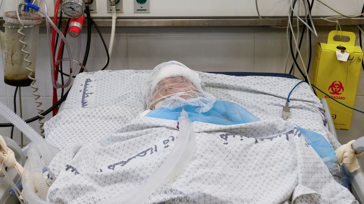 طفل فلسطيني مصاب في وحدة العناية المركزة في مستشفى بغزة حيث لا تقبل إلا الحالات الحرجة (رويترز)